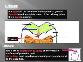 It is found in the bottom of developmental groove.
Results from incomplete union of the primary lobes.
It is a fault in enamel.
3- FISSURE:
It is a broad depression or valley on the occlusal
surfaces of posterior teeth.
Its inclines meet in a developmental groove and extend
to the cusp tips.
SULCUS:
Cusp tip
Cusp tip
Dentin
Enamel
Fissure
Developmental
groove
 