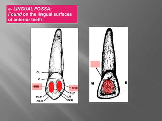 a- LINGUAL FOSSA:
Found on the lingual surfaces
of anterior teeth.
LF
 