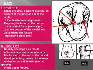 a- TRUE PITS:
These are small pinpoint depression.
present at the junction / or at the
ends
of the developmental grooves.
They may be found at the bottom
of the central fossa (central pit)
or at the bottom of the mesial and
distal triangular fossae
(mesial and distal pits).
2- PITS:
b- FAULTY PIT
Usually develops as a result
of incomplete formation of enamel.
It is located at the end of the buccal
developmental grooves of the lower
molars or palatal developmental
grooves
of the upper molars.
c.p
.
d.p
.
m.p
.
p.p. b.p.
 