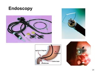 Endoscopy 