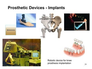 Prosthetic Devices  - Implants Robotic device for knee prosthesis implantation 