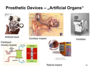 Prosthetic Devices – „Artificial Organs“ Artificial heart Cochlear implant Retinal implant Ventilator Cardiopul-monary bypass 