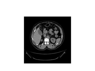 Introduction - gastrointestinal radiology.pptx