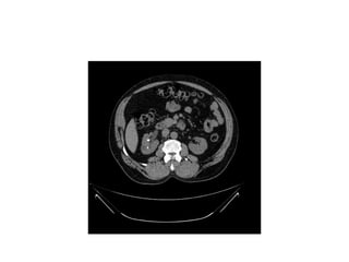Introduction - gastrointestinal radiology.pptx