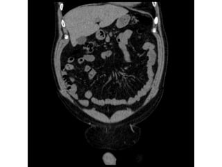 Introduction - gastrointestinal radiology.pptx