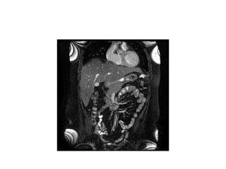 Introduction - gastrointestinal radiology.pptx