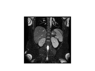 Introduction - gastrointestinal radiology.pptx