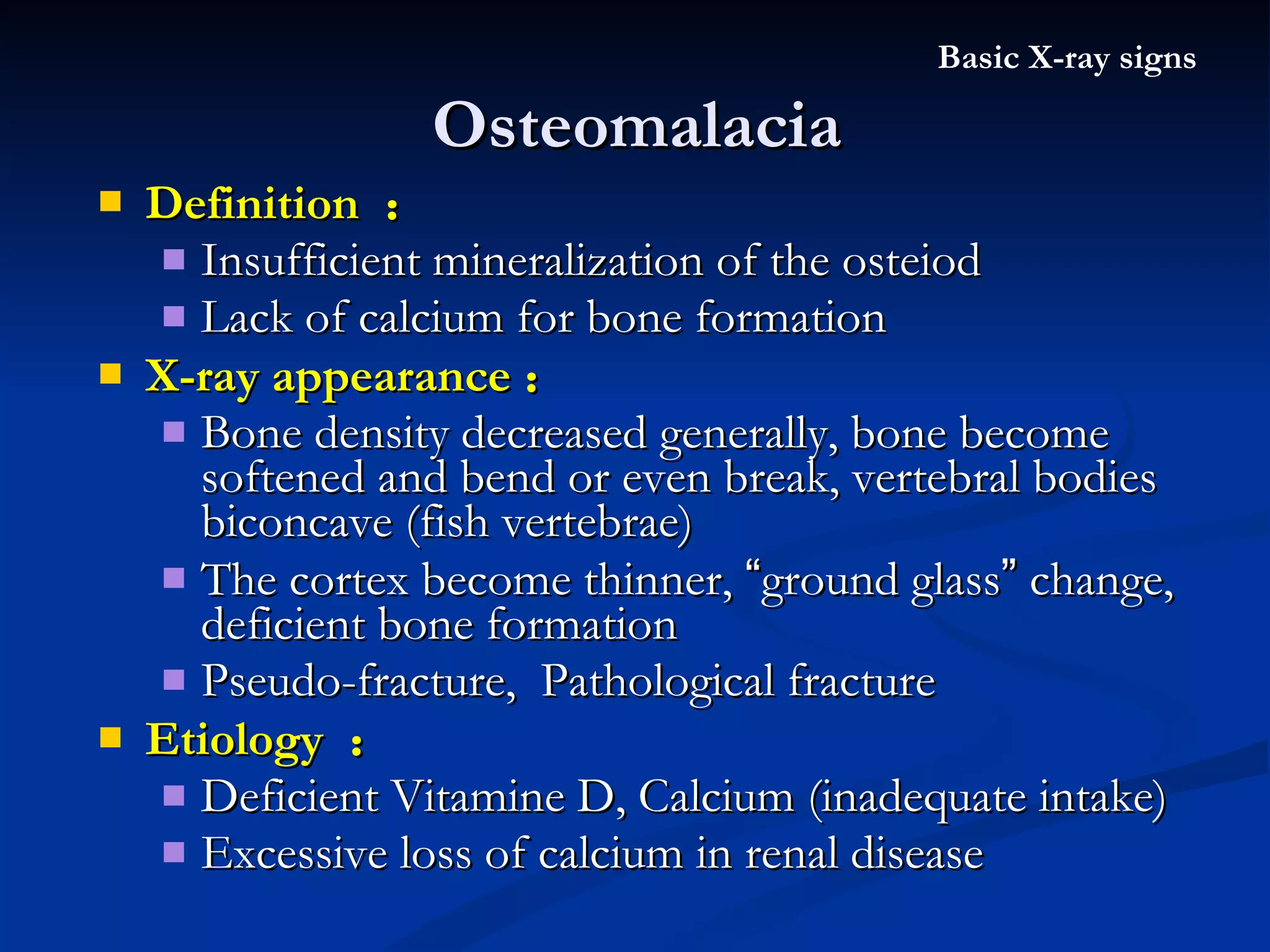Osteomalacia Definition  ： Insufficient mineralization of the osteiod Lack of calcium for bone formation  X-ray appearance ： Bone density decreased generally, bone become softened and bend or even break, vertebral bodies biconcave (fish vertebrae) The cortex become thinner,  “ ground glass ”  change, deficient bone formation Pseudo-fracture,  Pathological fracture Etiology  ： Deficient Vitamine D, Calcium (inadequate intake) Excessive loss of calcium in renal disease Basic X-ray signs 