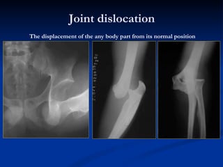 Dislocation Body Introduction skeletal radiology(11月20.) | PPT