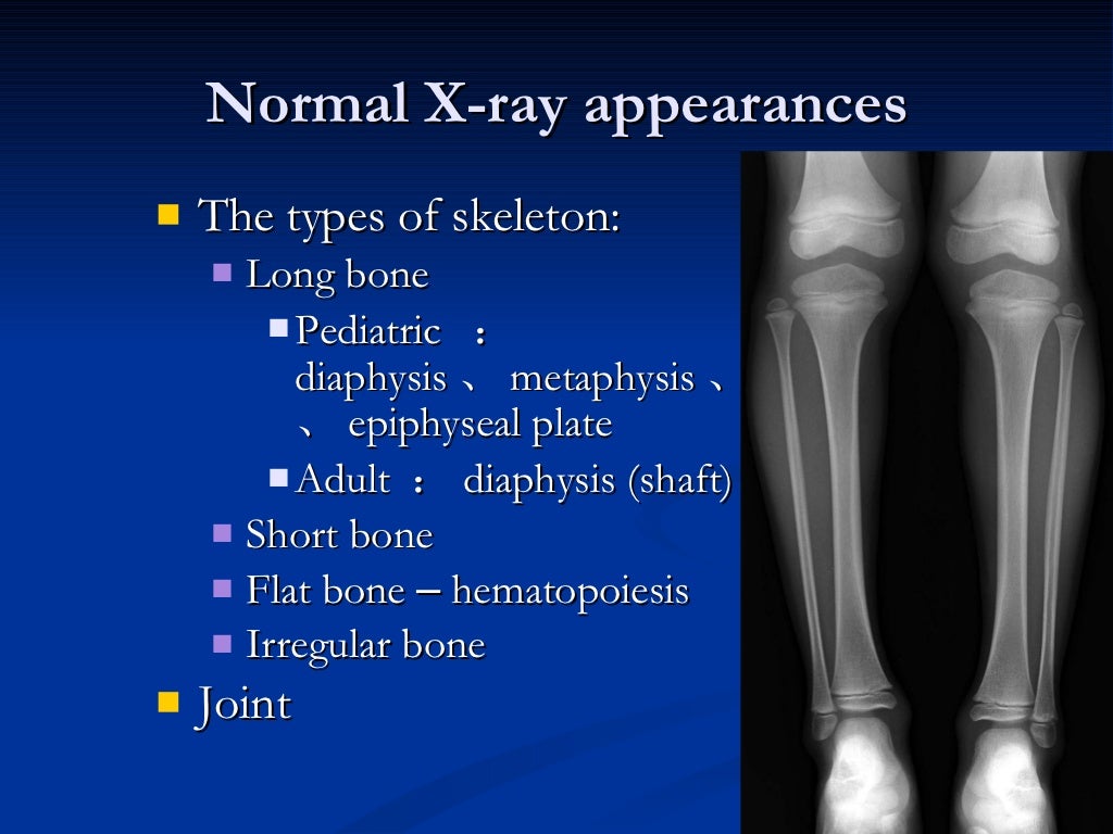 Introduction skeletal radiology(11月20.)
