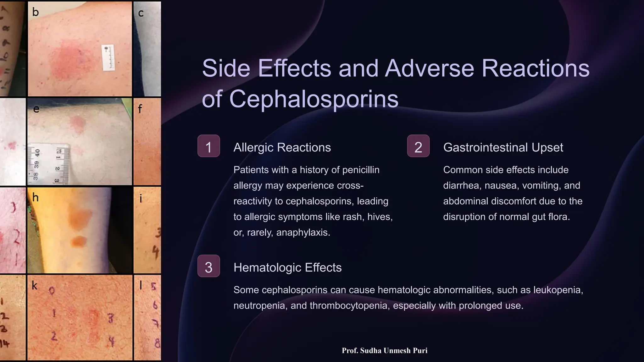 Cephamtrique Introduction-to-Cephalosporins-Chemotherapy in short..pptx