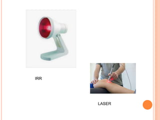 IRR
LASER
 