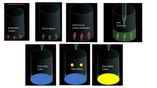 Add H2SO4
Antibodies
Coated
Add Antigens
Add Enzyme
Linked Antibodies
Add
Substrate
Gives Blue
Colur
Give Yellow
Colour
 