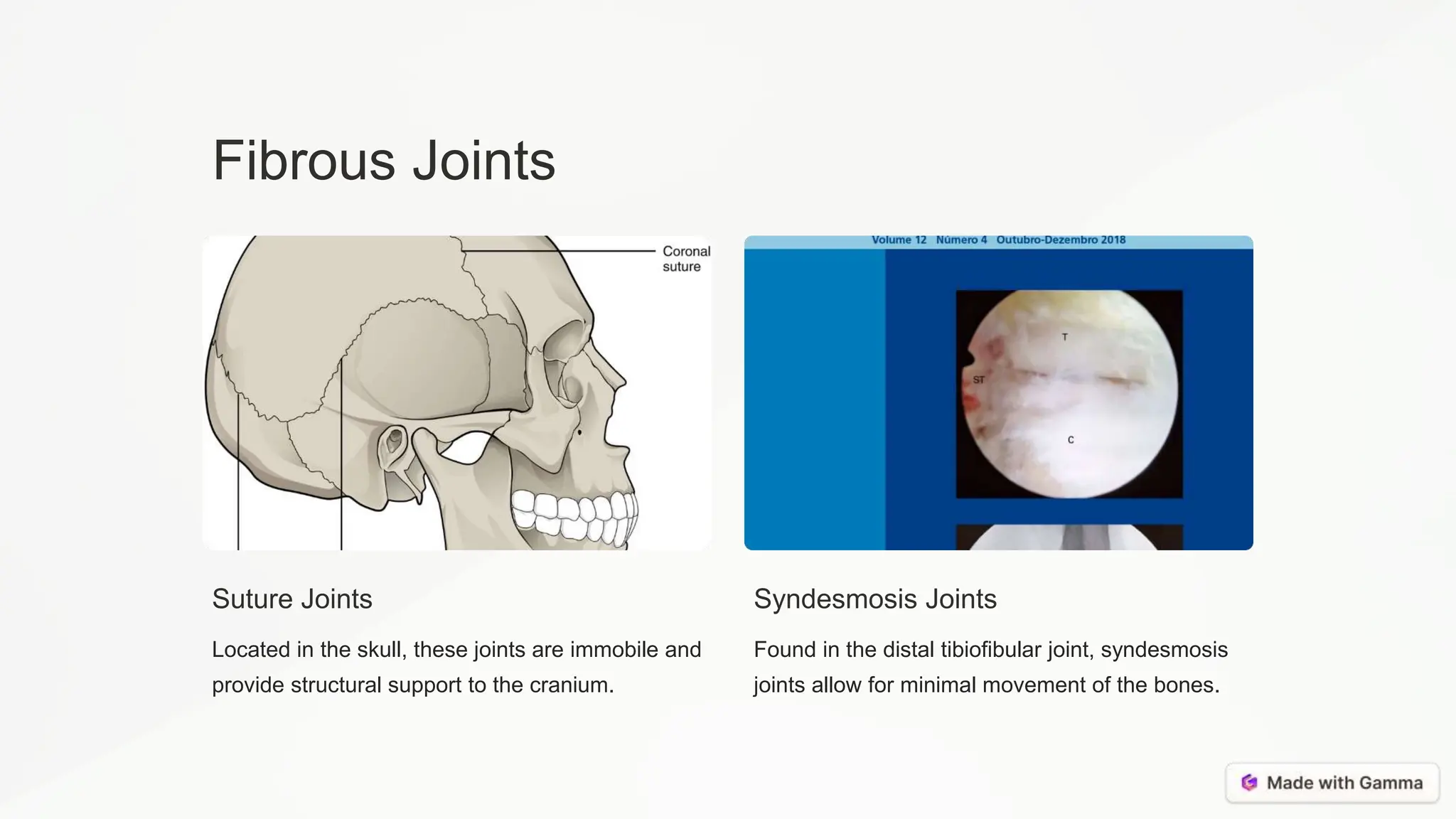 Fibrous Joints
Suture Joints
Located in the skull, these joints are immobile and
provide structural support to the cranium.
Syndesmosis Joints
Found in the distal tibiofibular joint, syndesmosis
joints allow for minimal movement of the bones.
 