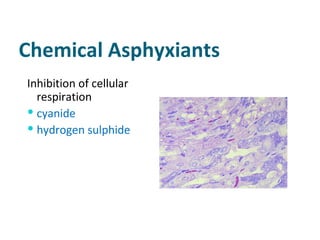 Chemical Asphyxiants Inhibition of cellular respiration cyanide  hydrogen sulphide 