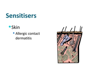 Sensitisers Skin Allergic contact dermatitis 