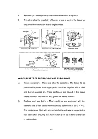 45
2. Reduces processing time by the action of continuous agitation.
3. This eliminates the possibility of human errors of leaving the tissue for
long time in one solution due to forgetfulness.
VARIOUS PARTS OF THE MACHINE ARE AS FOLLOWS
(a) Tissue containers - These are also the cassettes. The tissue to be
processed is placed in an appropriate container, together with a label
and the lid snapped on. These containers are placed in the tissue
basket in which they remain throughout the whole process.
(b) Beakers and wax baths - Most machines are equipped with ten
beakers and 2 wax baths thermostatically controlled at 56°C + 4°C.
The beakers are filled with appropriate fluids and wax is placed in the
wax baths after ensuring that main switch is on, so as to keep the wax
in molten state.
Paraffin embedding (2-4) The process of tissue embedding in L-mould
(5) Plastic mould and (6) Paraffin block
 