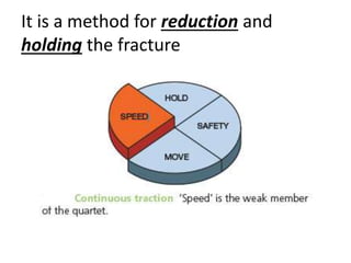 It is a method for reduction and
holding the fracture
 