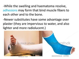 -While the swelling and haematoma resolve,
adhesions may form that bind muscle fibers to
each other and to the bone.
-Newer substitutes have some advantage over
plaster (they are impervious to water, and also
lighter and more radiolucent.)
 