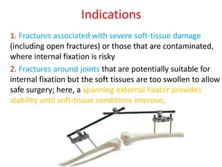 Indications
1. Fractures associated with severe soft-tissue damage
(including open fractures) or those that are contaminated,
where internal fixation is risky
2. Fractures around joints that are potentially suitable for
internal fixation but the soft tissues are too swollen to allow
safe surgery; here, a spanning external fixator provides
stability until soft-tissue conditions improve.
 