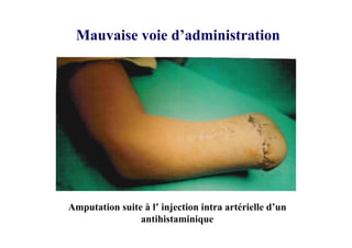 Mauvaise voie d’administration
Amputation suite à l’ injection intra artérielle d’un
antihistaminique
 