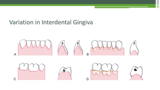 Clinical Periodontology - Introduction & Anatomy | PDF