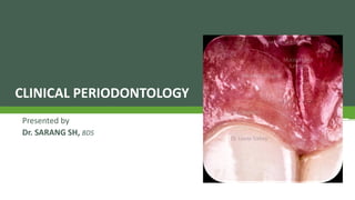 CLINICAL PERIODONTOLOGY
Presented by
Dr. SARANG SH, BDS
 