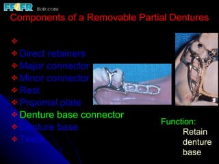 Rest Connector Rpd Introduction and basic components of rpd's copy | PPT
