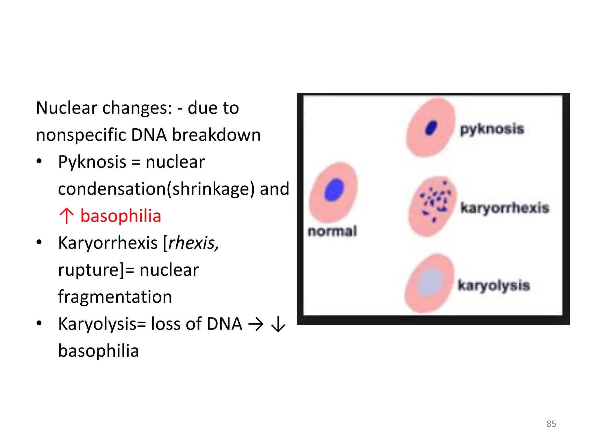 Nuclear changes: - due to
nonspecific DNA breakdown
• Pyknosis = nuclear
condensation(shrinkage) and
↑ basophilia
• Karyorrhexis [rhexis,
rupture]= nuclear
fragmentation
• Karyolysis= loss of DNA → ↓
basophilia
85
 