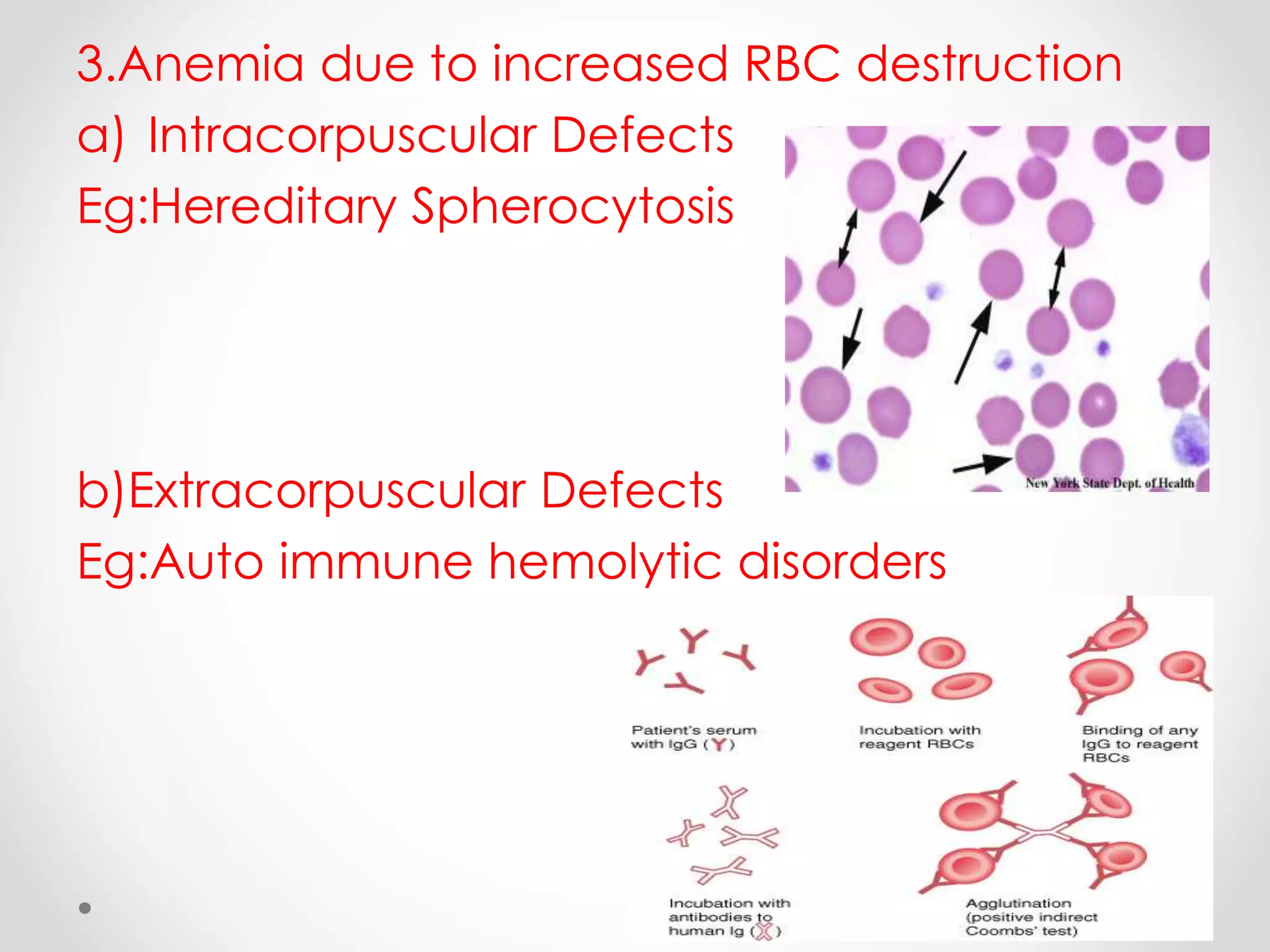 Intracorpuscular Defect Introduction and classification of anemia’s | PPTX