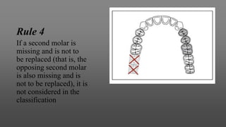 Rule 4
If a second molar is
missing and is not to
be replaced (that is, the
opposing second molar
is also missing and is
not to be replaced), it is
not considered in the
classification
 