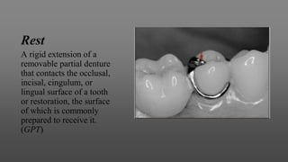 Rest
A rigid extension of a
removable partial denture
that contacts the occlusal,
incisal, cingulum, or
lingual surface of a tooth
or restoration, the surface
of which is commonly
prepared to receive it.
(GPT)
 