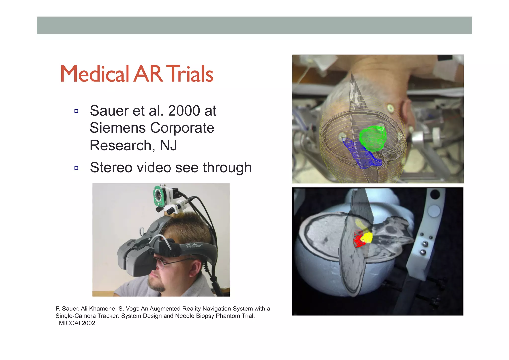 MedicalARTrials
!  Sauer et al. 2000 at
Siemens Corporate
Research, NJ
!  Stereo video see through
F. Sauer, Ali Khamene, S. Vogt: An Augmented Reality Navigation System with a
Single-Camera Tracker: System Design and Needle Biopsy Phantom Trial,
MICCAI 2002
 