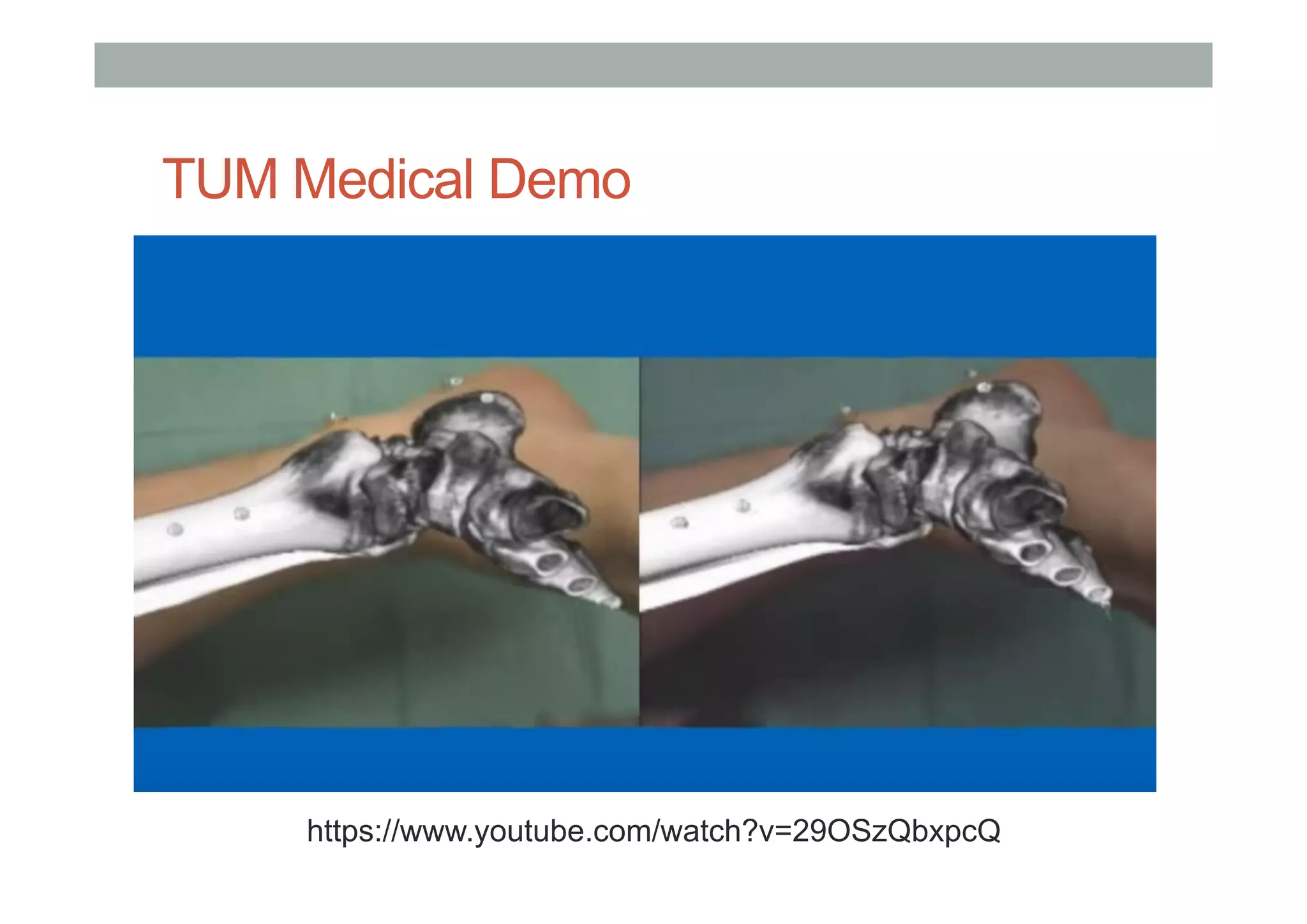 TUM Medical Demo
https://www.youtube.com/watch?v=29OSzQbxpcQ
 
