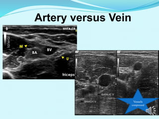 Introduction course to Ultrasound Vascular Access | PPTX