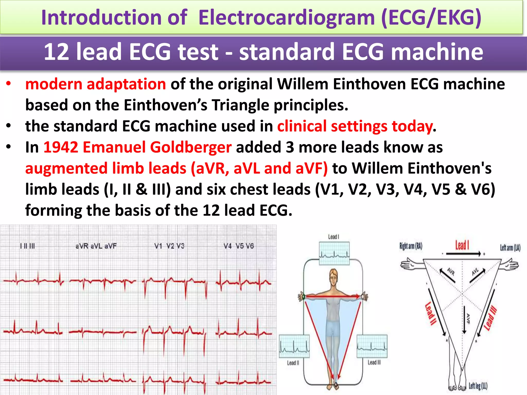 Conquer The Ecg:  The Easy Way To Identify Posterior Mi - 01r9iii