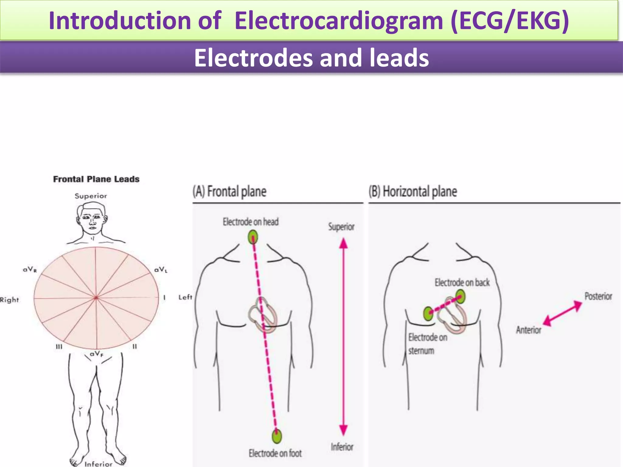 Conquer The Ecg:  The Easy Way To Identify Posterior Mi - gnz4rdn