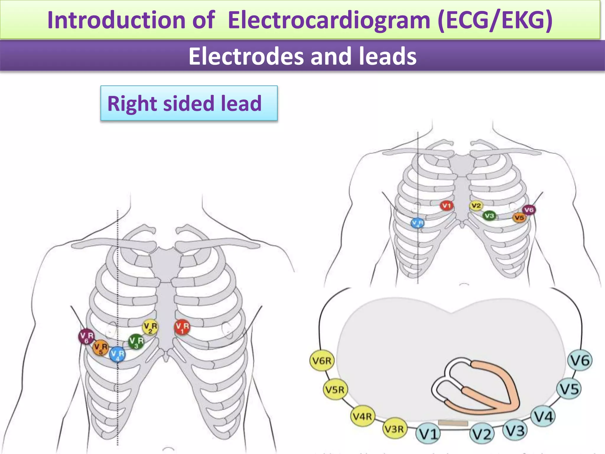 Conquer The Ecg:  The Easy Way To Identify Posterior Mi - 1dmxk8z