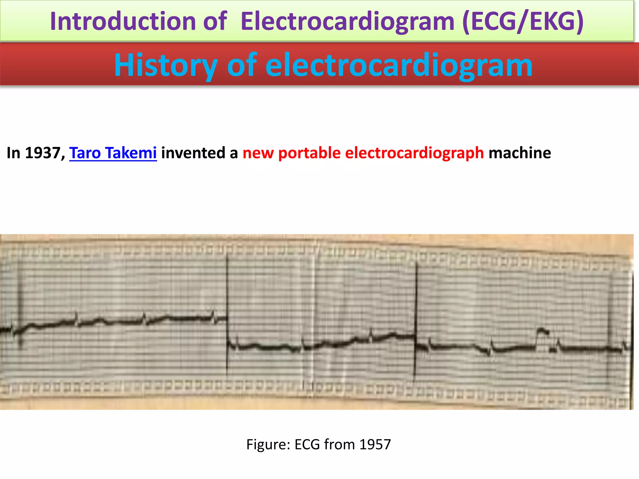 Conquer The Ecg:  The Easy Way To Identify Posterior Mi - us7pndj