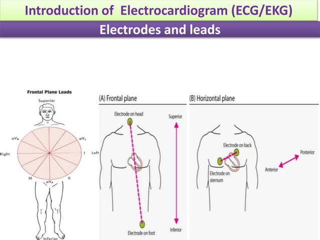 Persons Ecg Example Fundamentals of ECG -Introduction | PPSX