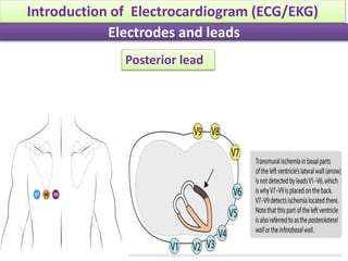 Posterior lead
Electrodes and leads
Introduction of Electrocardiogram (ECG/EKG)
 