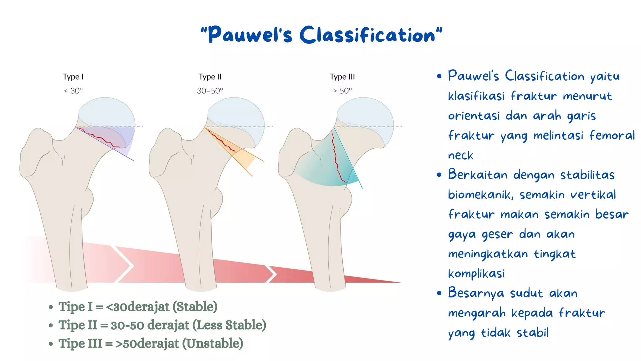 Introduction Hip Fracture_Putri Karina.pdf