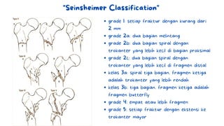 "Seinsheimer Classification"
grade 1: setiap fraktur dengan kurang dari
2 mm
grade 2a: dua bagian melintang
grade 2b: dua bagian spiral dengan
trokanter yang lebih kecil di bagian proksimal
grade 2c: dua bagian spiral dengan
trokanter yang lebih kecil di fragmen distal
kelas 3a: spiral tiga bagian. fragmen ketiga
adalah trokanter yang lebih rendah
kelas 3b: tiga bagian. fragmen ketiga adalah
fragmen butterfly
grade 4: empat atau lebih fragmen
grade 5: setiap fraktur dengan ekstensi ke
trokanter mayor
 