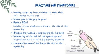 FRACTURE HIP SYMPTOMPS
Inability to get up from a fall or to walk which
may radiate to the knee
Severe pain in the grip or groin
Reduce ROM
Inability to put weight on the leg on the side of the
injured hip
Bruising and swelling in and around the hip area
Shorter leg on the side of the injured hip and
external rotation of leg if significantly displaced
Outward turning of the leg on the side of the
injured hip
 