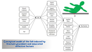 Conceptual model of the fall-induced hip
fracture procedure and associated
effective factors
 
