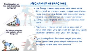Low Energy trauma: paling umum pada pasien lansia
Direct: jatuh ke trokanter mayor (valgus impaksi) atau
rotasi eksternal yang dipaksa pada ekstremitas bawah
menjepit neck osteroporotik ke posterior acetabulum
Indirect: otot mengatasi atau menagan kekuatan leber
femur
1.
2.
MECHANISM OF FRACTURE
High Energy Trauma: terjadi fraktur pada neck of
femur pada pasien yang lebih muda dan lebih tua, seperti
kecelakaan kendaraan atau jatuh dari ketinggian
Cyclic Loading-Stress Fractures: terjadi pada atlet,
militer, penari balet, pasien dengan osteoporosis dan
osteopenia berada pada posisi tertentu
 