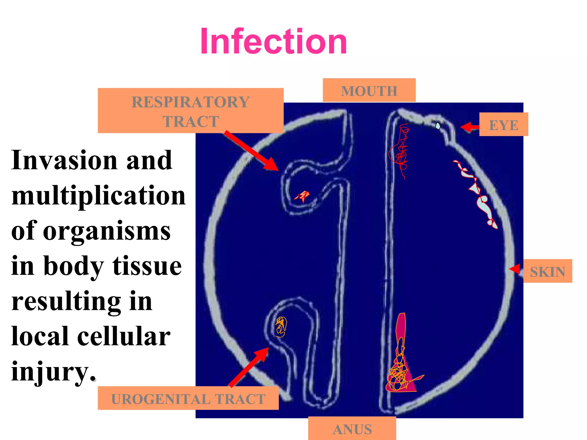 EYE
SKIN
UROGENITAL TRACT
ANUS
MOUTH
RESPIRATORY
TRACT
Infection
Invasion and
multiplication
of organisms
in body tissue
resulting in
local cellular
injury..
 