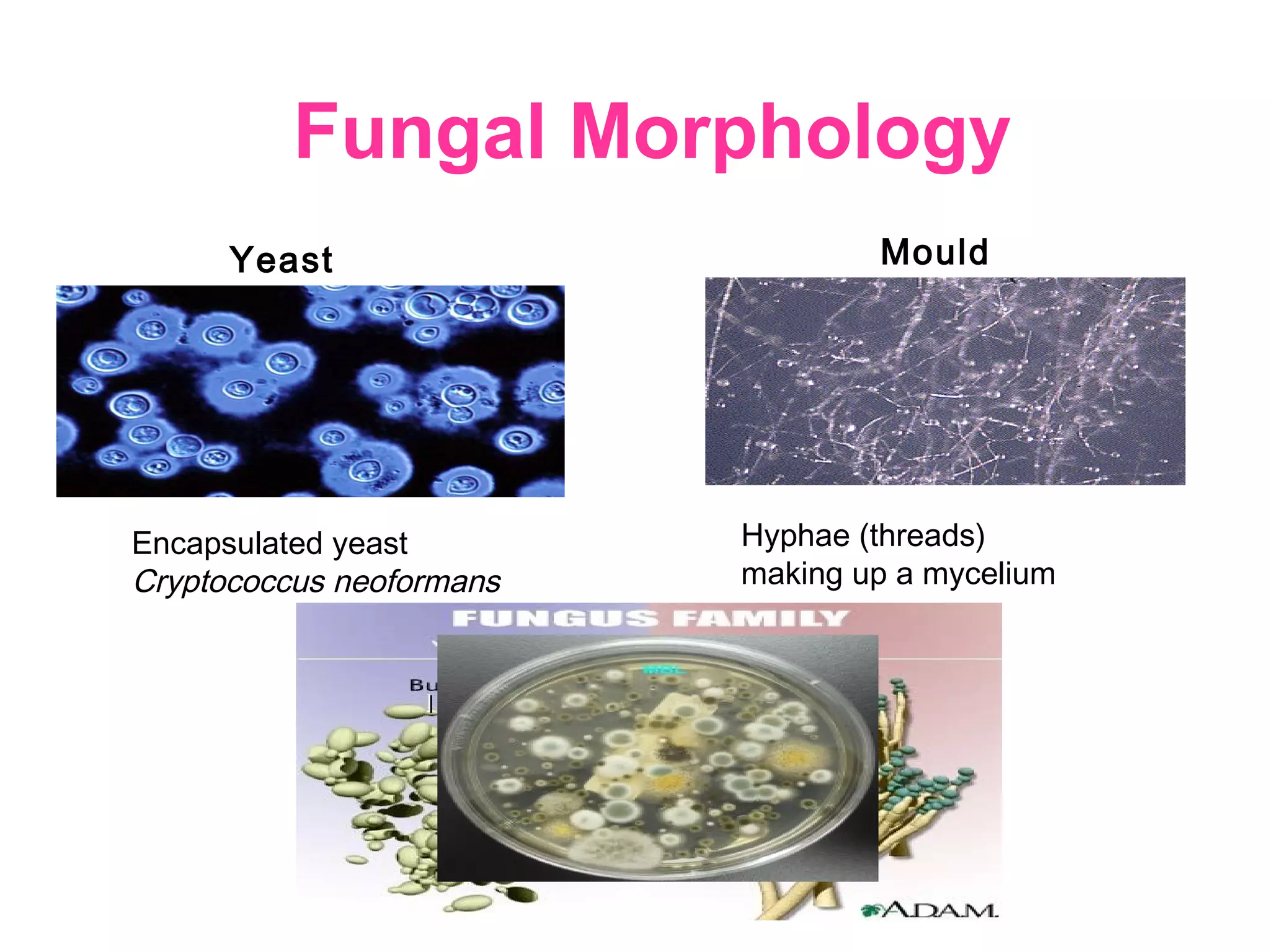 Fungal Morphology
Yeast
Hyphae (threads)
making up a mycelium
Mould
Encapsulated yeast
Cryptococcus neoformans
 