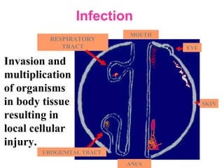 EYE
SKIN
UROGENITAL TRACT
ANUS
MOUTH
RESPIRATORY
TRACT
Infection
Invasion and
multiplication
of organisms
in body tissue
resulting in
local cellular
injury..
 