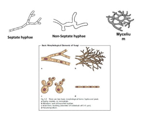 Septate hyphae Non-Septate hyphae Myceliu
m
 